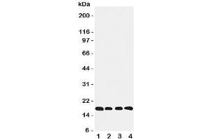 Western blot testing of Cyclophilin B antibody and Lane 1:  rat ovary;  2: HeLa;  3: 293T;  4: A431 cell lysate (PPIB Antikörper  (C-Term))