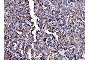IHC analysis of CD147/Emmprin using anti-CD147/Emmprin antibody (ABIN7599997). (CD147 Antikörper  (AA 138-323))