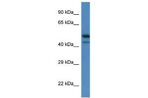 WB Suggested Anti-Sbk1 Antibody   Titration: 1. (SBK1 Antikörper  (C-Term))