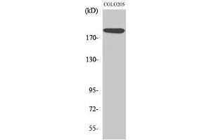 Western Blotting (WB) image for anti-Mediator Complex Subunit 1 (MED1) (Thr2647) antibody (ABIN3187328) (MED1 Antikörper  (Thr2647))