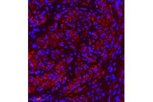 Immunofluorescence (Paraffin-embedded Sections) (IF (p)) image for anti-Myosin Light Chain 6, Alkali, Smooth Muscle and Non Muscle (MYL6) antibody (ABIN7074734)
