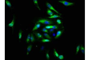 Immunofluorescence staining of Hela cells with ABIN7152853 at 1:166, counter-stained with DAPI. (FGFRL1 Antikörper  (AA 403-470))
