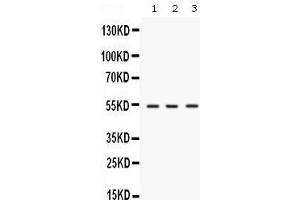 Western blot analysis of SPTLC1 expression in rat brain extract (lane 1), mouse brain extract (lane 2) and MCF-7 whole cell lysates (lane 3). (SPTLC1 Antikörper  (C-Term))