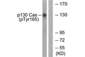 Western blot analysis of extracts from HepG2 cells treated with EGF 200ng/ml 30', using p130 Cas (Phospho-Tyr165) Antibody. (BCAR1 Antikörper  (pTyr165))