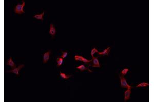 Immunofluorescence (fixed cells) (IF/ICC) image for anti-S100 Calcium Binding Protein A1 (S100A1) (N-Term) antibody (ABIN6264894)