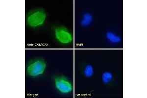 (ABIN570984) Immunofluorescence analysis of paraformaldehyde fixed U251 cells, permeabilized with 0. (CaMKII alpha/beta (Internal Region) Antikörper)