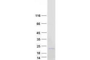 NANOS2 Protein (Myc-DYKDDDDK Tag)