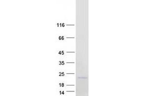 NANOS2 Protein (Myc-DYKDDDDK Tag)