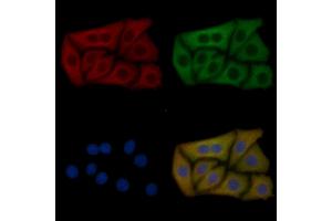 BCL7C Mouse Monoclonal Antibody staining Hela cells by IF/ICC. (BCL7C Antikörper  (Internal Region))