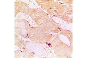 Immunohistochemical analysis of Dysferlin staining in human muscle formalin fixed paraffin embedded tissue section.