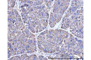 IHC analysis of RPN1 using anti-RPN1 antibody (ABIN7600447).