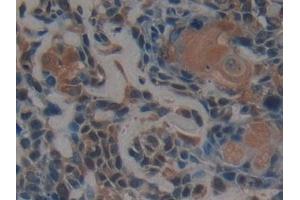 Immunohistochemistry (IHC) image for anti-Proteasome (Prosome, Macropain) 26S Subunit, Non-ATPase, 9 (PSMD9) (AA 2-223) antibody (ABIN7442213)