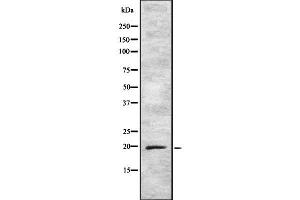 Western blot analysis of ARF5 using K562 whole cell lysates