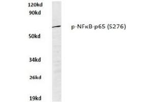 Image no. 1 for anti-Nuclear Factor-kB p65 (NFkBP65) (pSer276) antibody (ABIN318082) (NF-kB p65 Antikörper  (pSer276))