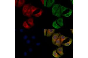 ABIN6265268 and ABIN6278321 staining Hela cells by IF/ICC.