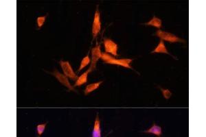 Immunofluorescence analysis of NIH-3T3 cells using MMP10 Polyclonal Antibody at dilution of 1:100 (40x lens).