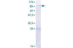 CHDH Protein (AA 1-594) (GST tag)