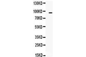 Western Blotting (WB) image for anti-Transporter 2, ATP-Binding Cassette, Sub-Family B (MDR/TAP) (TAP2) (AA 611-651), (C-Term) antibody (ABIN3043415)