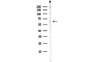 Western blot analysis of lysates from COLO205 cells, using Phospho-NF-kB p65 (Ser281) Antibody at 1/1000 dilution.
