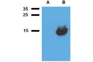 Western blot analysis of polyclonal anti-Mycobacterium tuberculosis antigen Acr1.