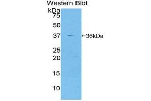 Western Blotting (WB) image for anti-Glutamate Decarboxylase 2 (Pancreatic Islets and Brain, 65kDa) (GAD2) (AA 65-105) antibody (ABIN1858941)