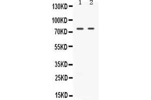 Western blot analysis of TAK1 expression in rat spleen extract ( Lane 1) and HELA whole cell lysates ( Lane 2). (MAP3K7 Antikörper  (C-Term))