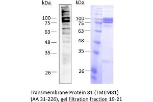 Western Blotting (WB) image for Transmembrane Protein 81 (TMEM81) (AA 31-226) protein (His tag) (ABIN3074693)