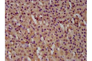 IHC image of ABIN7154578 diluted at 1:500 and staining in paraffin-embedded human adrenal gland tissue performed on a Leica BondTM system. (GTPBP1 Antikörper  (AA 562-669))