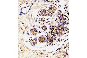Antibody staining LALBA in Human breast tissue sections by Immunohistochemistry (IHC-P - paraformaldehyde-fixed, paraffin-embedded sections).