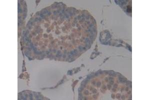 IHC-P analysis of Human Tissue, with DAB staining. (DNAH11 Antikörper  (AA 17-299))
