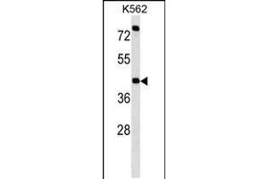 Western Blotting (WB) image for anti-Purinergic Receptor P2X, Ligand Gated Ion Channel 2 (P2RX2) (AA 81-109), (N-Term) antibody (ABIN5535126)