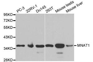 Western blot analysis of extracts of various cell lines, using MNAT1 antibody. (MNAT1 Antikörper  (AA 1-309))