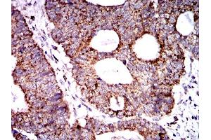 Immunohistochemistry (IHC) image for anti-Superoxide Dismutase 2, Mitochondrial (SOD2) (AA 1-222) antibody (ABIN5888812) (SOD2 Antikörper  (AA 1-222))