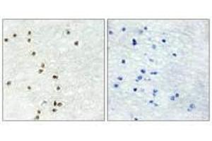 Immunohistochemistry analysis of paraffin-embedded human brain tissue using ZIC1/2/3 antibody. (ZIC1 Antikörper)