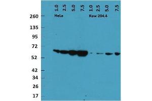 Gels were loaded with 1, 2. (HSPD1 Antikörper)