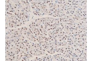 ABIN6267073 at 1/100 staining human duodenum tissue sections by IHC-P. (CHEK1 Antikörper  (pSer280))