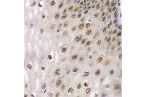 Immunohistochemistry (Paraffin-embedded Sections) (IHC (p)) image for anti-DEAD (Asp-Glu-Ala-Asp) Box Polypeptide 5 (DDX5) (AA 1-614) antibody (ABIN6139505)