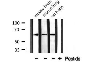 Western blot analysis of extracts from various tissue, using CDKAL antibody.