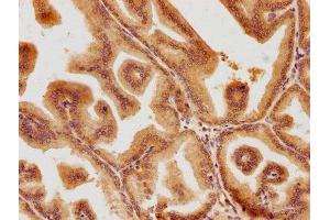 Immunohistochemistry (IHC) image for anti-Proteasome (Prosome, Macropain) 26S Subunit, Non-ATPase, 6 (PSMD6) (AA 355-372), (Regulatory Subunit 6) antibody (ABIN7139704)