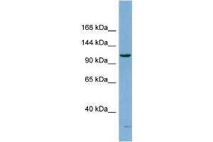 WB Suggested Anti-DHX15 Antibody Titration:  0. (DHX15 Antikörper  (N-Term))