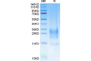 Cynomolgus BST2 on Tris-Bis PAGE under reduced condition. (BST2 Protein (AA 49-163) (His tag))