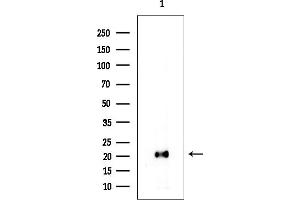 anti-Cytochrome B5 Domain Containing 2 (CYB5D2) antibody