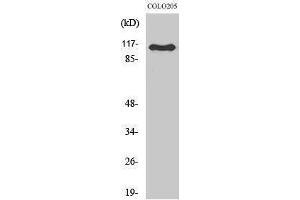 Western Blotting (WB) image for anti-RhoGEF p115 (Internal Region) antibody (ABIN3180863) (RhoGEF p115 (Internal Region) Antikörper)