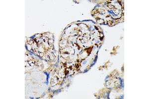 Immunohistochemistry of paraffin-embedded human placenta using Fibrinogen alpha chain (FGA) (FGA) Rabbit mAb (ABIN7267177) at dilution of 1:100 (40x lens). (FGA Antikörper)
