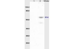 Lane 1: mouse brain lysates Lane 2: mouse lung lysates probed with Anti Phospho-Lyn (Tyr507) Polyclonal Antibody, Unconjugated (ABIN743603) at 1:200 in 4 °C. (LYN Antikörper  (pTyr508))
