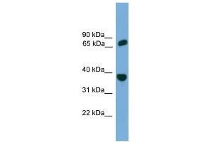WB Suggested Anti-POT1 Antibody Titration: 0. (POT1 Antikörper  (Middle Region))