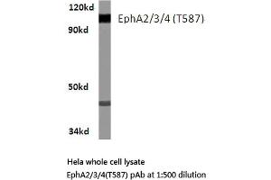 Western blot (WB) analysis of EphA2/3/4 antibody in extracts from Hela cells. (EPH Receptor A2 Antikörper)