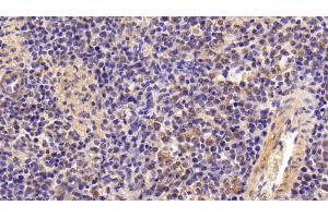 Immunohistochemistry (IHC) image for anti-Gelsolin (GSN) (AA 674-782) antibody (ABIN7442174)