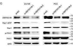 DEPDC1B regulates the Rho signaling pathway and binds to Rac1. (PAK1 Antikörper  (AA 1-240))