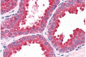 Human Prostate (formalin-fixed, paraffin-embedded) stained with DUSP1 antibody ABIN351458 at 3. (DUSP1 Antikörper  (AA 355-367))